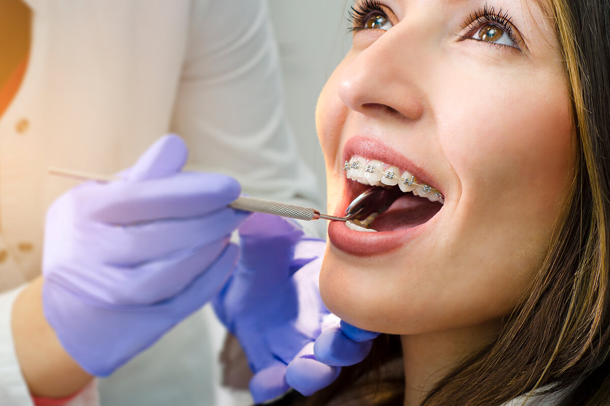 Get the Best Braces in Minnetonka, MN